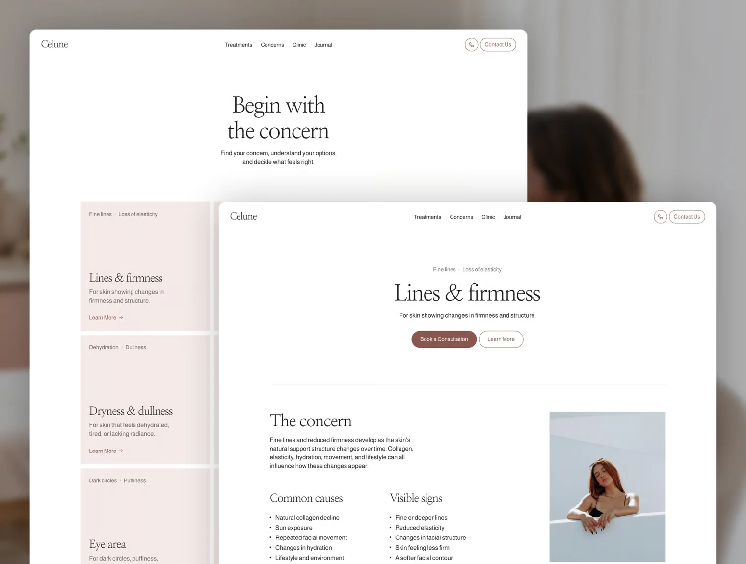 Celune – Skin Clinic 3